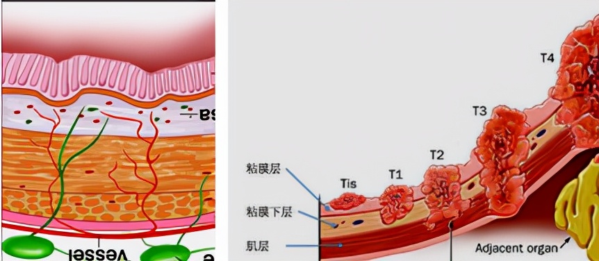 我不是药神,我不是财迷!若患胃癌,这些靶向药你有能力负担吗?