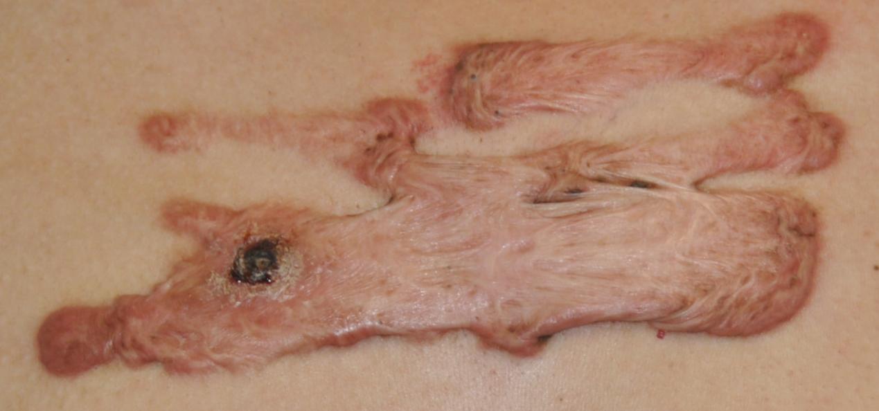 协和整形医生谈整容,你到底该不该整容