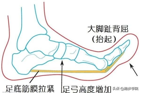 足底筋膜炎改善和解决的方法,足底筋膜炎的预防治疗和恢复