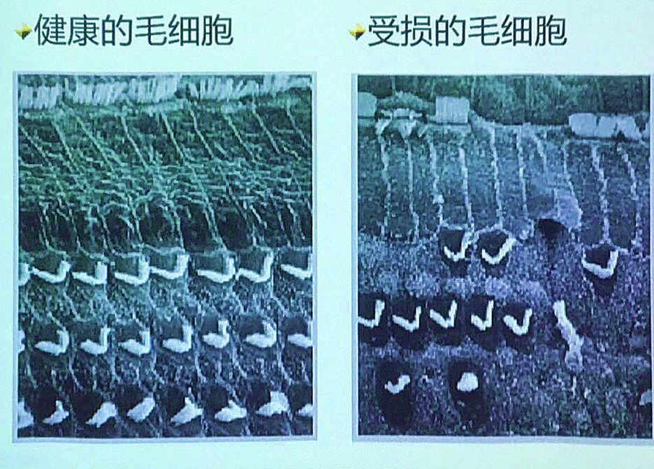 第一次戴助听器要知道的事情,科普佩戴助听器有哪些常见误区