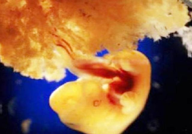 组图*放播**精子和卵子结合全过程,精子:找个媳妇,太难了