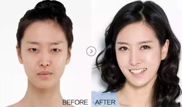 把水光针当饭吃？这位网红简直丧心病狂！整容后年入千万