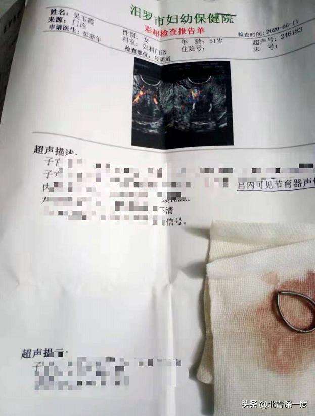 “隐身”23年的节育环:拿到二胎准生证后不断寻医问药,结果发现乡计生委的取环手术,并未将“环”取出