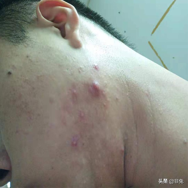 非兔fw03测评,非兔魔手测评