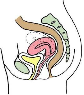 子宫位置前位怎么容易受孕,弓形子宫怀孕的几率是多少
