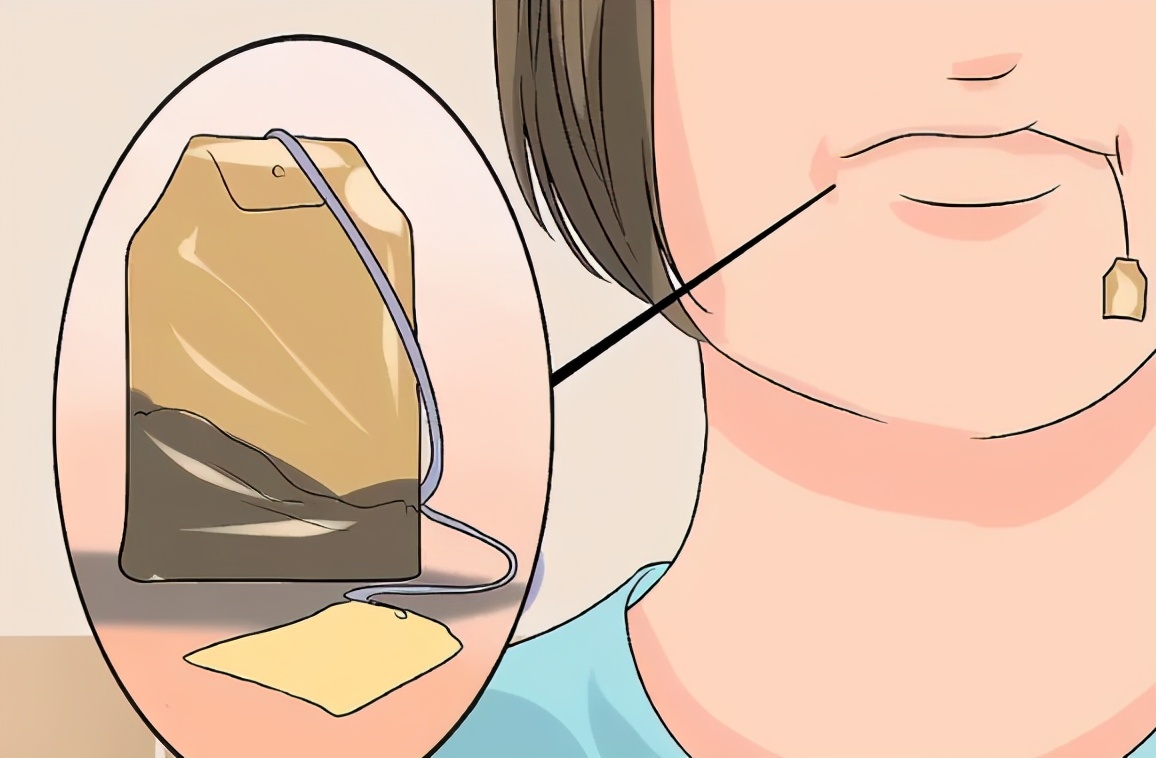 拔牙后怎样能促进牙洞愈合,牙龈伤口一年还没愈合怎么治疗