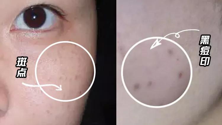 无效遮瑕测评,无效遮脸