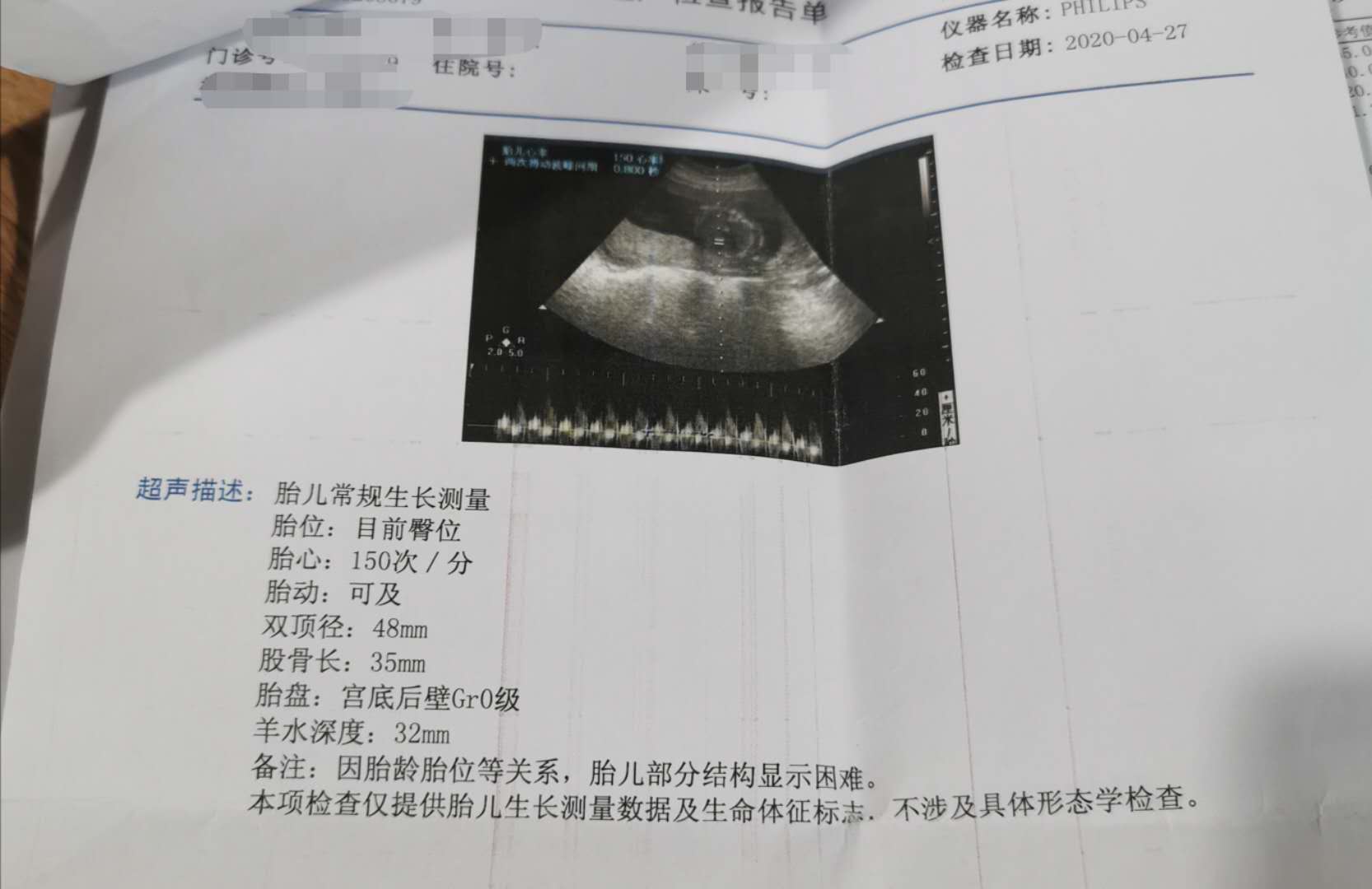 孕早期会不会引起甲亢或者甲减,记录十个月孕期