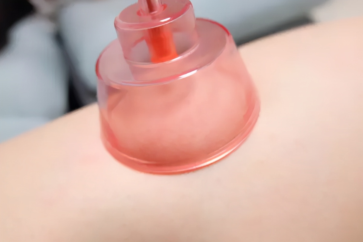 左点智能砭石走罐刮痧按摩器,左点砭石刮痧器效果怎么样