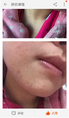 爆痘闭口做什么项目,爆闭口怎么办