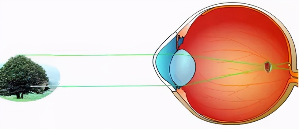 日本洼田眼镜台湾出售价格,日本推出治疗近视的眼镜