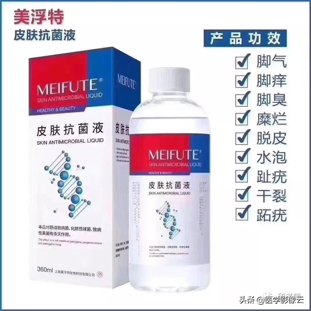 足部扁平苔藓,足癣病例