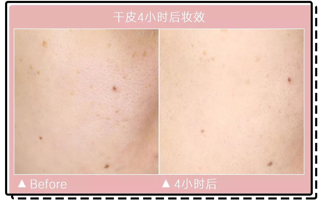 十大公认好用的混油皮粉底液排名,珀莱雅粉底液适合干皮还是油皮