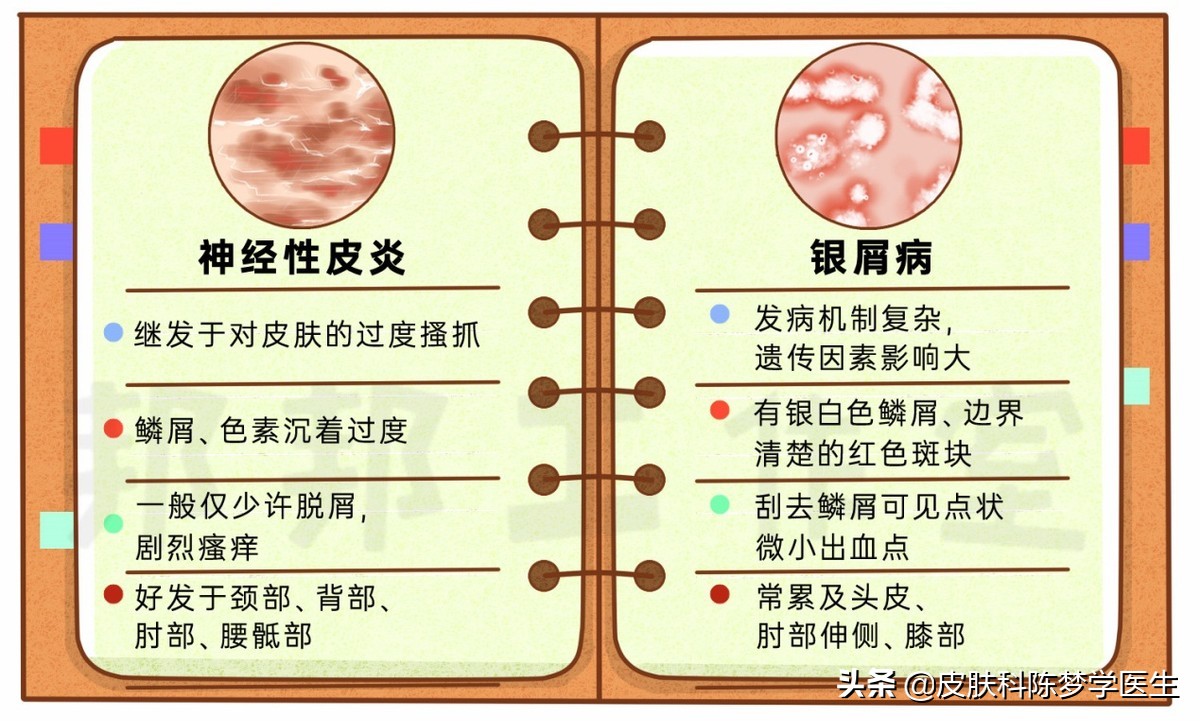红色斑块脱屑一定是牛皮癣吗,皮肤上有癣起皮颜色呈褐色