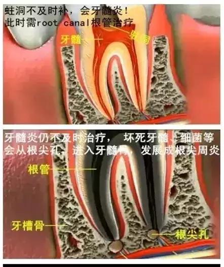 牙齿正面有小黑点千万不要忽视,不要小看牙齿的小黑点