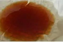 为什么中国这么多胃癌,为什么说胃癌超过5年就没事了