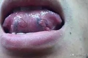 舌头反映了身体的哪些器官,舌头出现信号对身体有什么危险