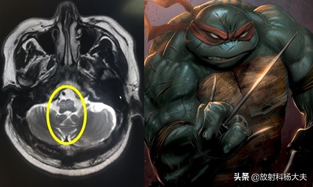 放射科趣味图片,放射科亮点图片