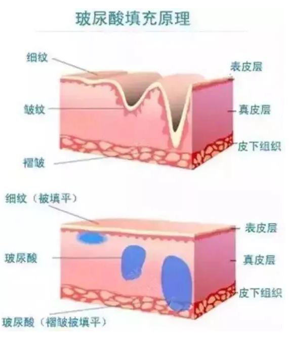 科普|光子嫩肤全攻略，做了光子后禁忌事项有哪些？