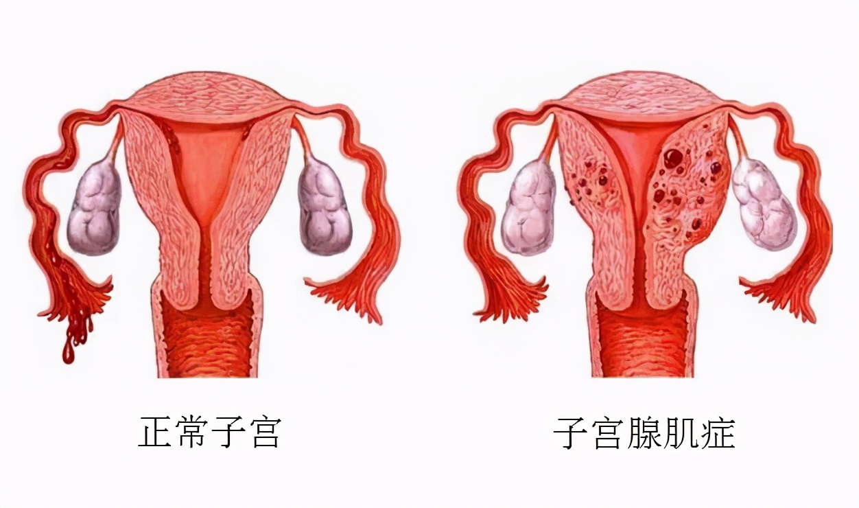 女人的痛不是你能体会的,女人的痛不过是为你而痛