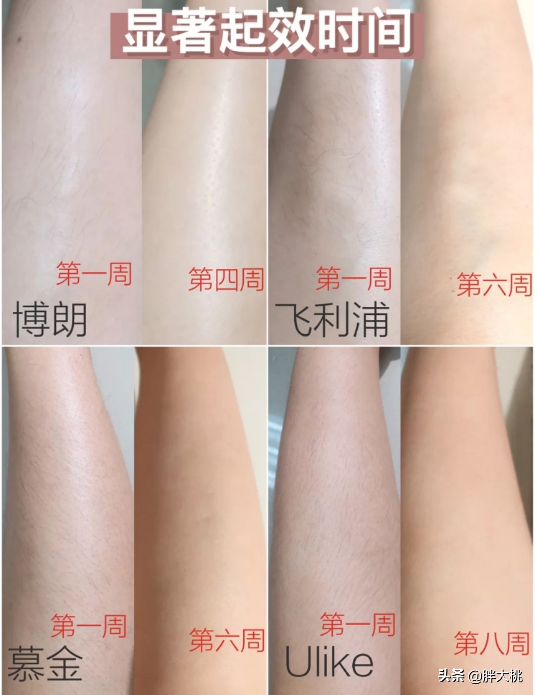 猕猴桃女孩必备脱毛仪,猕猴桃女孩脱毛膏测评