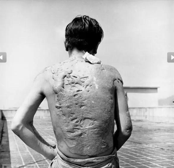 广岛长崎被原子弹轰炸还能住人吗,广岛被原子弹轰炸过的现状