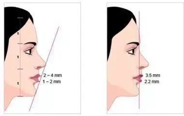 脸胖下巴尖是怎么回事,脸圆不一定是胖怎么办