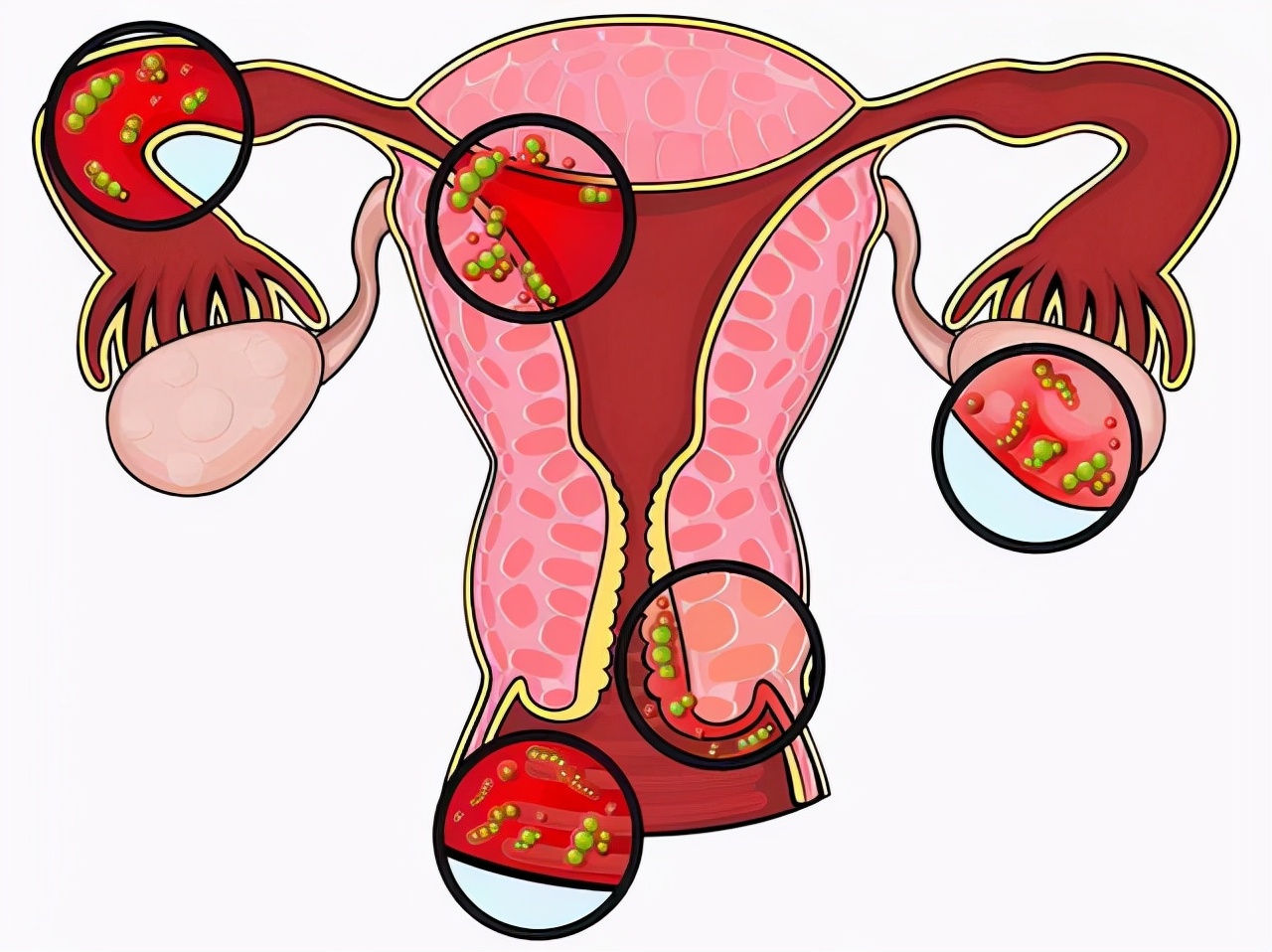 宫颈若病变大腿的变化,宫颈病变会导致腿部颜色异常吗