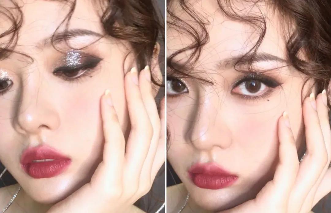 全脸点痣变美,点痣能变美吗