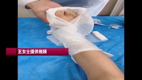 攀岩小孩摔伤怎么处理,攀岩孩子摔伤怎么处理