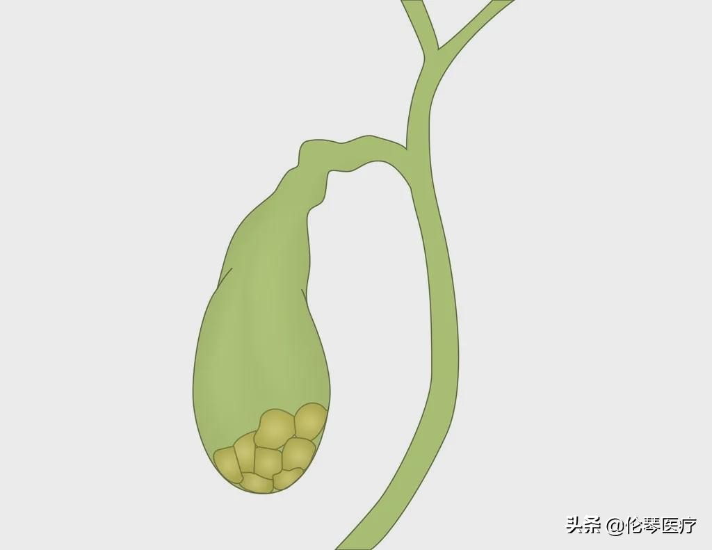 2022年恶性肿瘤筛查与预防指南,常见恶性肿瘤的预防和筛检