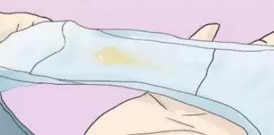 白带异常怎么看,白带异常有臭味