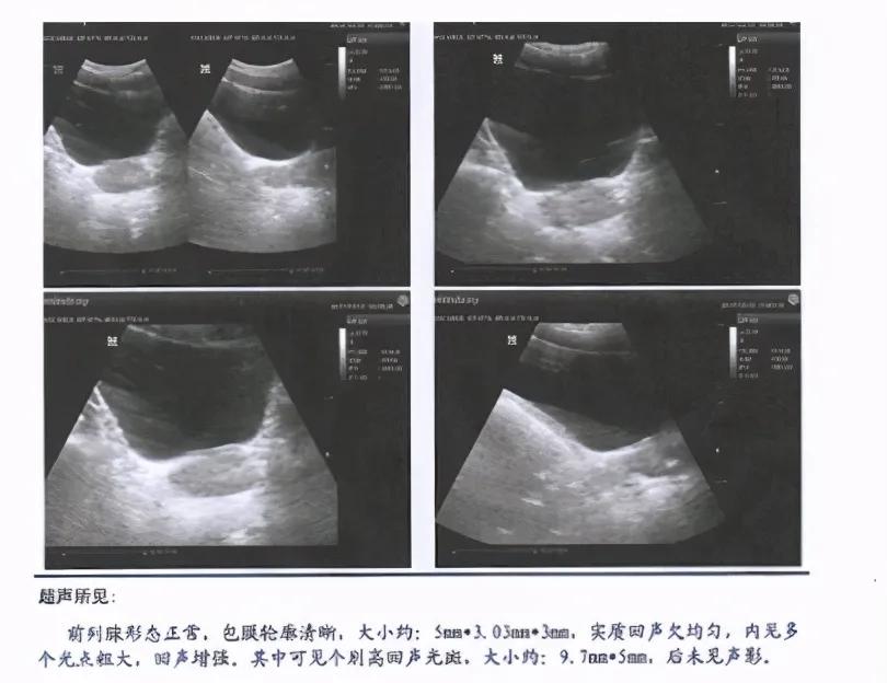 40岁男人前列腺症状怎么治疗,男人三十岁有了前列腺这是什么病