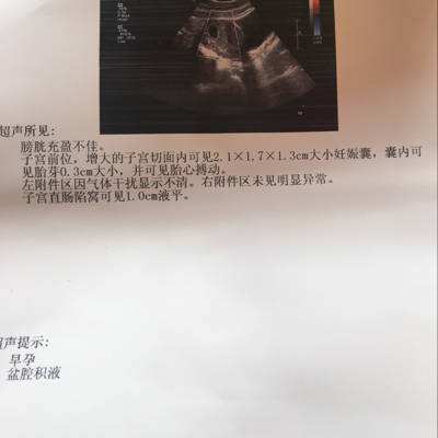 怀孕初期注意事项及产检报告指标,孕早期注意事项视频