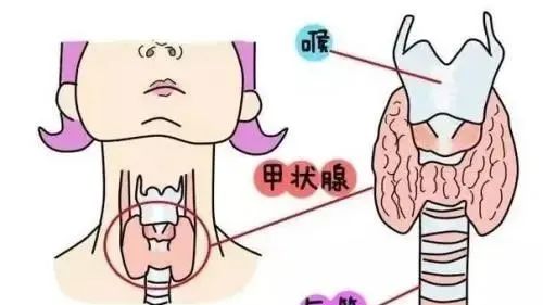 体检检查出来甲状腺结节怎么办,公司体检甲状腺结节有影响吗