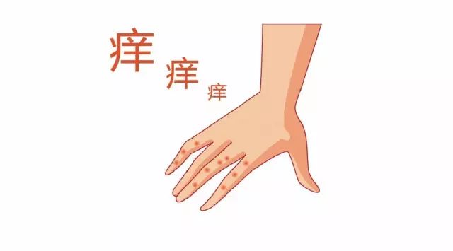 手上很多小水泡并痒会传染吗,脚气会传染到手上吗手上长小水泡