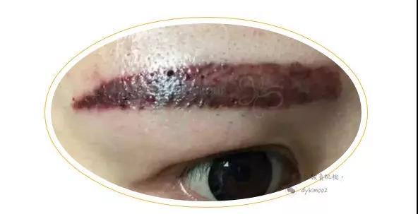 深圳传奇光学科技美容,深圳传奇光学祛斑仪器