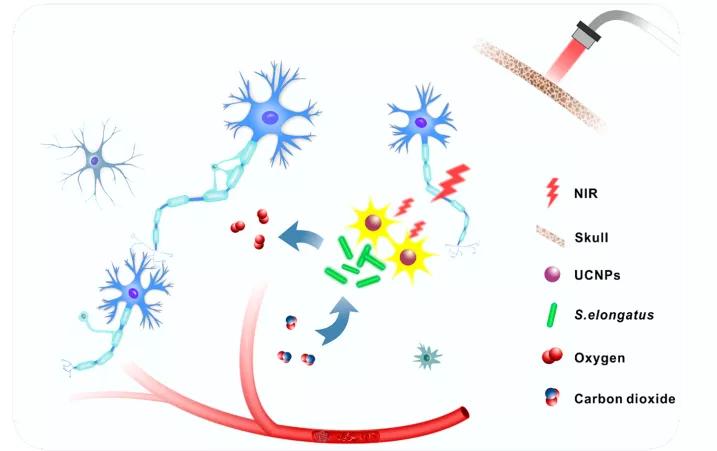 大脑缺氧怎么防治,脑科学日报图谱大全