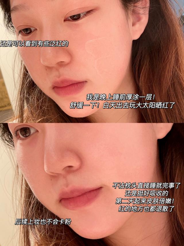 芦荟胶的正确详细用法,芦荟胶正确使用方式