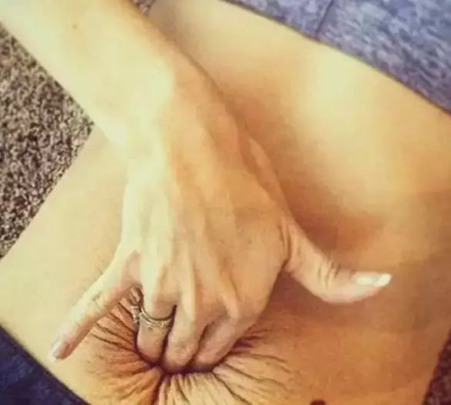 生育损害,生育后做哪些产后修复