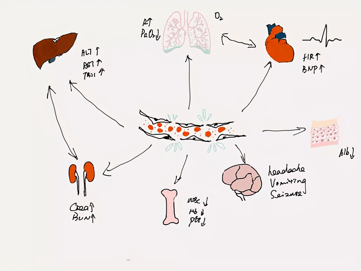 cart-t细胞治疗技术靠谱吗,科普car-t疗法