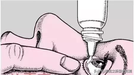 眼睛痛眼屎多眨眼痛怎么回事,眼睛痛痒眼屎多是什么原因