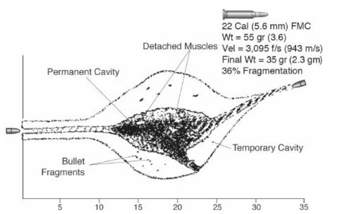 战伤救治常用技术病例分析题,战伤外科处理