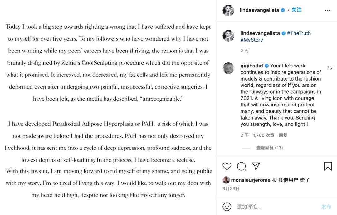 那个曾经没有10000美金不起床的超模，被医美毁容了