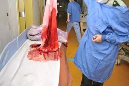 妇科疾病的介入治疗，这四种妇科疾病不用切除子宫也可以治好