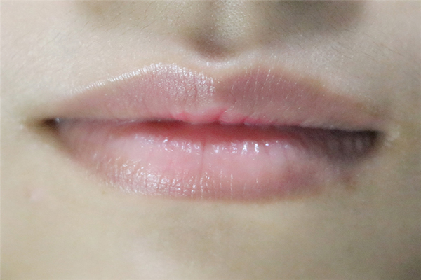 女性唇毛可以刮吗,女性唇毛比较多怎么调理