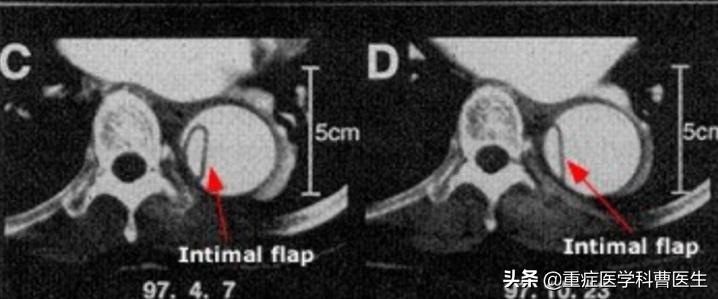 降压药不能擅自停服,降压药吃了不能吃啥