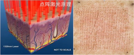 激光美容基础知识书籍,激光美容实用指南最新