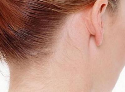 「丽皙白」脸部时常感到有刺痛感，那是你还没做好这几步护肤步骤！