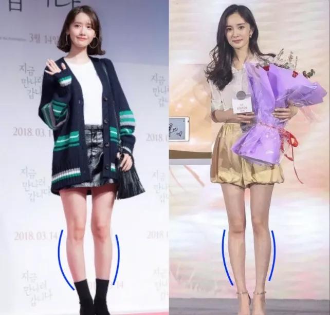 腿不直小腿外翻可以矫正过来吗,坐着改善小腿外翻明星